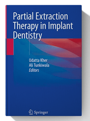 Partial Extraction Therapy in Implant Dentistry 1st ed