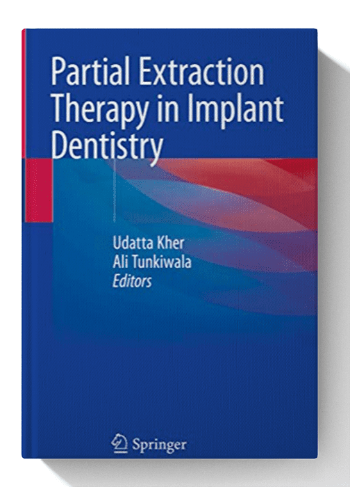 Partial Extraction Therapy in Implant Dentistry 1st ed