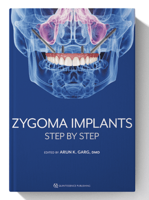 Zygoma Implants: Step by Step 1st Edition