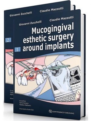 Mucogingival Esthetic Surgery Around Implants ( 2 Volumes)