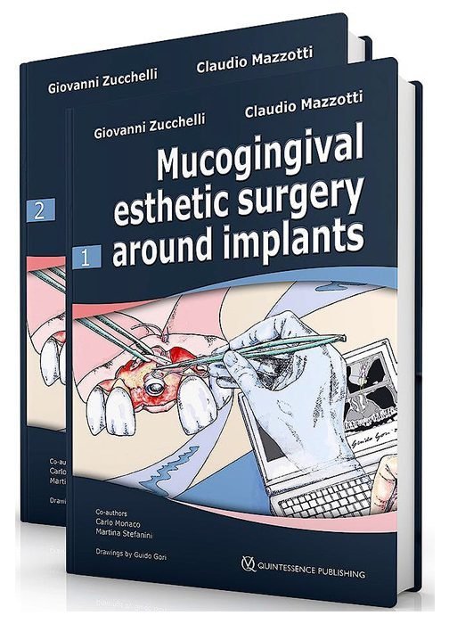 Mucogingival Esthetic Surgery Around Implants ( 2 Volumes)