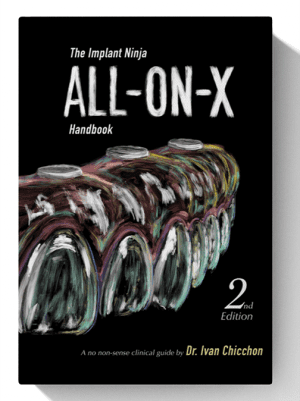 The Implant Ninja All-on-X Handbook: A Step by Step Clinical Guide 2nd Edition