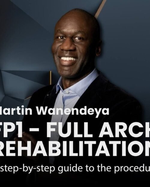 Alternative view of Digital FP1 Full-Arch Reconstruction: From Planning to Final Prosthesis