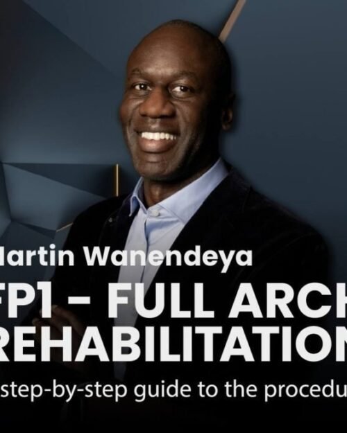 Digital FP1 Full-Arch Reconstruction: From Planning to Final Prosthesis