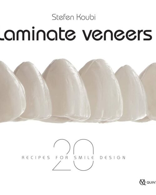Laminate Veneers 20 Recipes for Smile Design 1st Edition