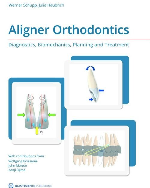 Aligner Orthodontics: Diagnostics, Biomechanics, Planning and Treatment 1st Edition (Scanned copy)