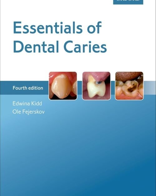 Essentials of Dental Caries