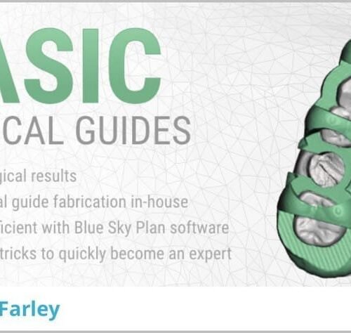 Basic Surgical Guides
