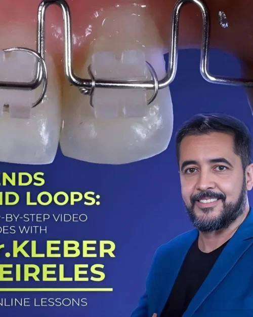 Bends and Loops: Step-by-step Video Guides with Dr. Kleber Meireles
