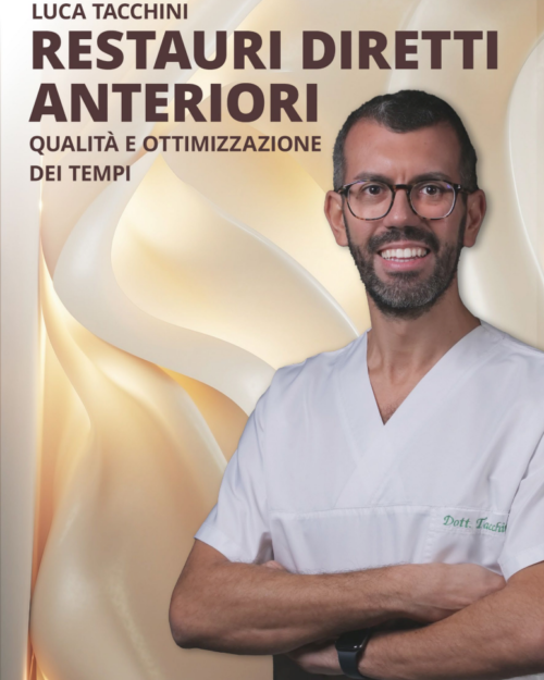 Restauri Diretti Anteriori