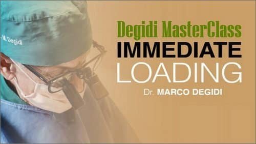 The Degidi Immediate Loading Protocol: Predictable Full-Arch Rehabilitation