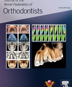Journal of the World Federation of Orthodontists: Full Archive (2012 – 2024)