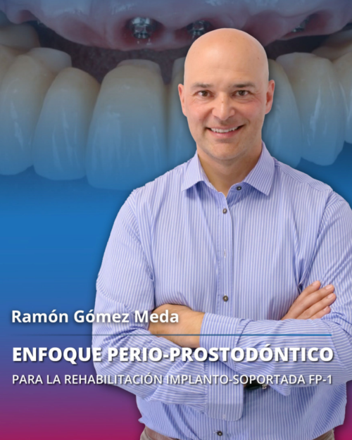 Rehabilitación Implanto-Soportada FP1: Enfoque Perio-Prostodóntico desde el Diagnóstico hasta la Entrega Final