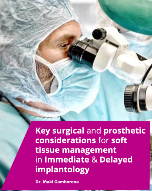 Soft Tissue Architecture in Implantology: Surgical & Prosthetic Protocols for Immediate vs. Delayed Loading