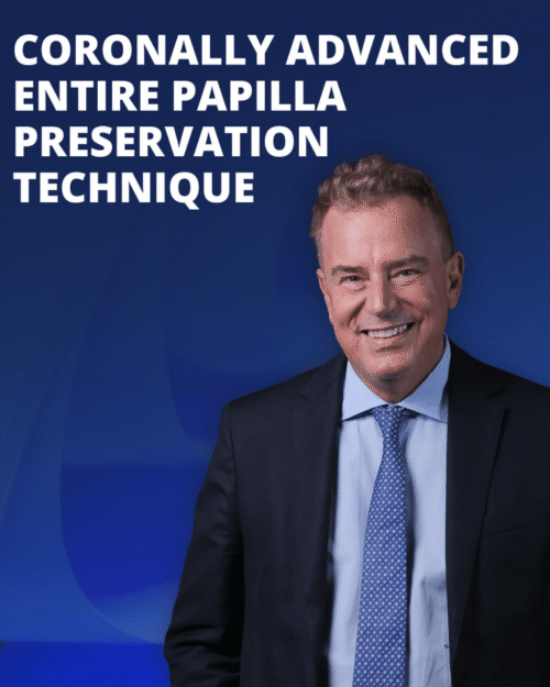 Coronally Advanced Entire Papilla Preservation Technique