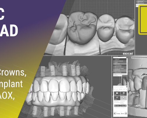 BASIC EXOCAD | Models, Crowns, Splints, Implant Crowns, AOX, & More