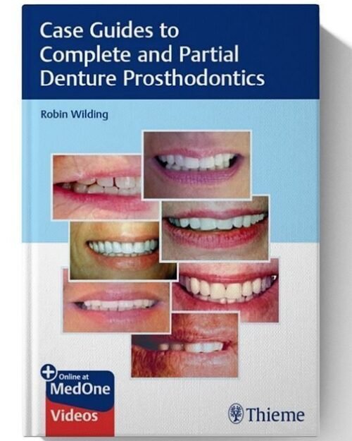 Case Guides to Complete and Partial Denture Prosthodontics