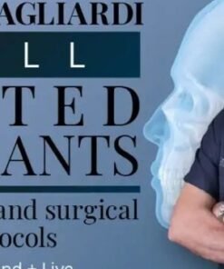 The Tilted Implant Approach: Biomechanics, Surgery and Prosthetic Solutions