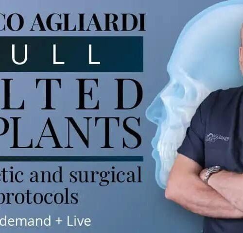 Alternative view of The Tilted Implant Approach: Biomechanics, Surgery and Prosthetic Solutions
