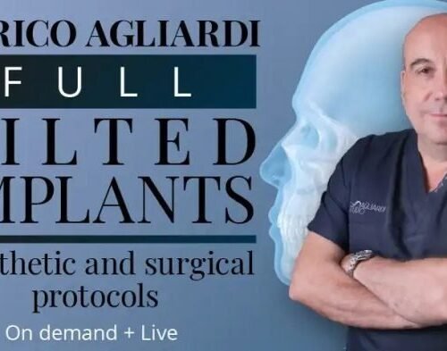 The Tilted Implant Approach: Biomechanics, Surgery and Prosthetic Solutions
