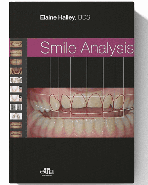 Smile Analysis 1st Edition