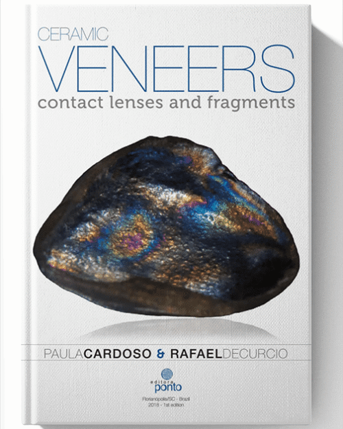 Ceramic Veneers Contact Lenses and Fragments