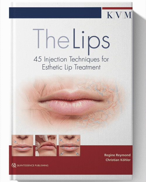The Lips: 45 Injection Techniques for Esthetic Lip Treatment 1st Edition (Scanned)