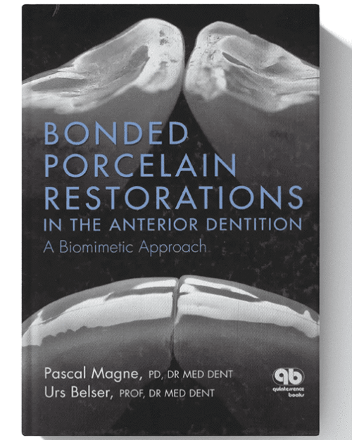 Bonded Porcelain Restorations in the Anterior Dentition: A Biomimetic Approach 1st Edition
