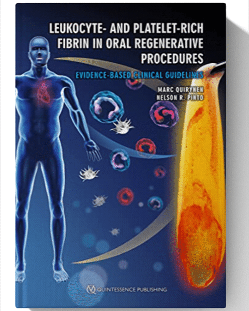 Leukocyte- and Platelet-Rich Fibrin in Oral Regenerative Procedures: Evidence-Based Clinical Guidelines 1st Edition