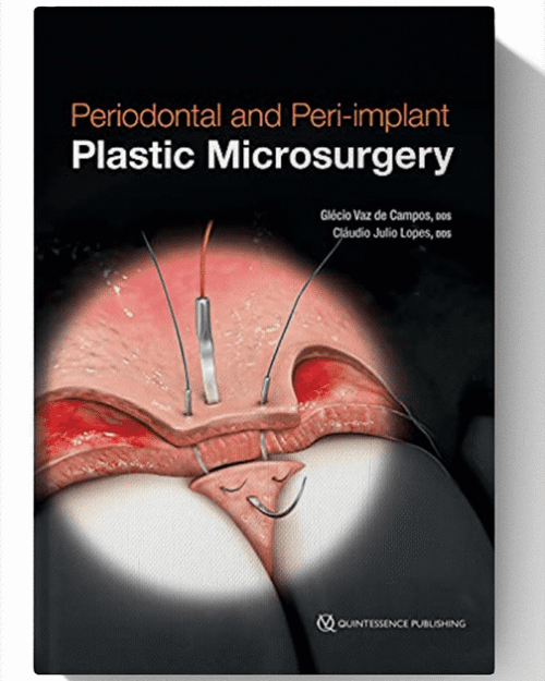 Periodontal and Peri-implant Plastic Microsurgery: Minimally Invasive Techniques with Maximum Precision