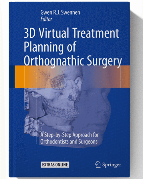 3D Virtual Treatment Planning of Orthognathic Surgery: A Step-by-Step Approach for Orthodontists and Surgeons 1st edition