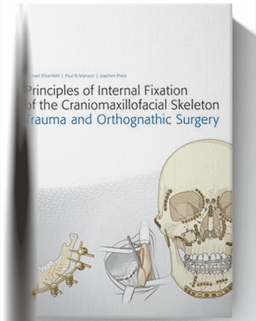 Principles of Internal Fixation of the Craniomaxillofacial Skeleton: Trauma and Orthognathic Surgery 1st Edition
