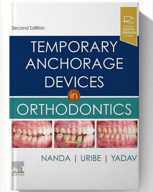 Temporary Anchorage Devices in Orthodontics 2nd Edition