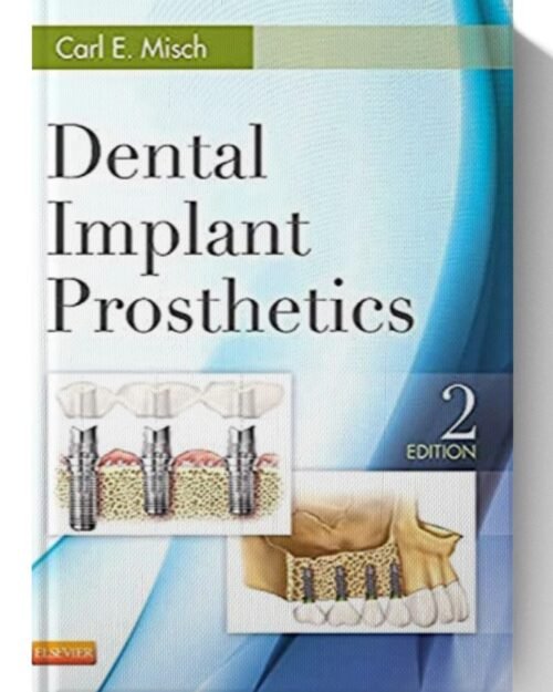 Dental Implant Prosthetics 2nd Edition