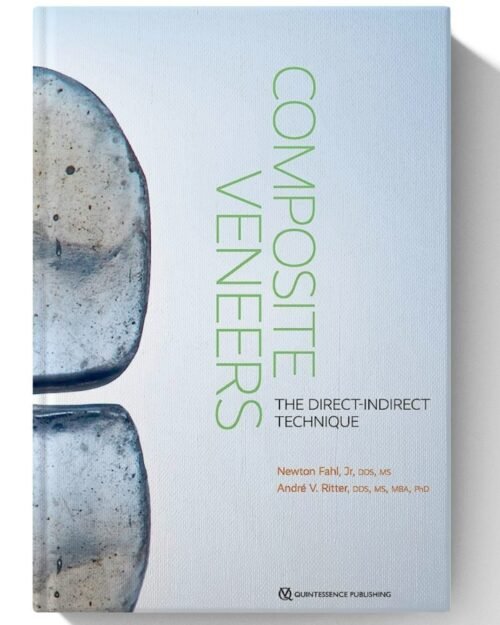 Composite Veneers: The Direct-Indirect Technique (Scanned)