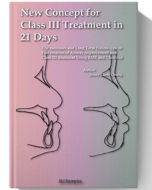 New Concept for Class III Treatment in 21 Days