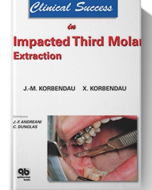 Clinical Success in Impacted Third Molar Extraction