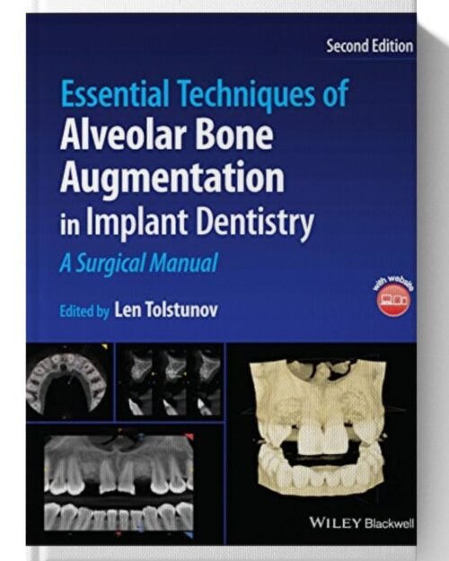 Essential Techniques of Alveolar Bone Augmentation in Implant Dentistry: A Surgical Manual 2nd Edition
