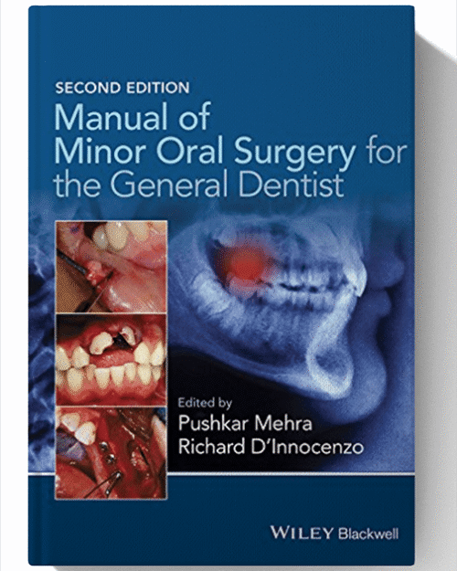 Manual of Minor Oral Surgery for the General Dentist 2nd Edition