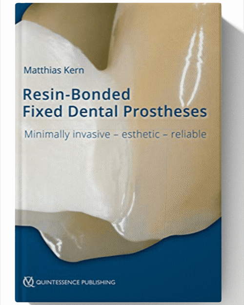 Resin-Bonded Fixed Dental Prostheses: Minimally invasive – esthetic – reliable 1st Edition