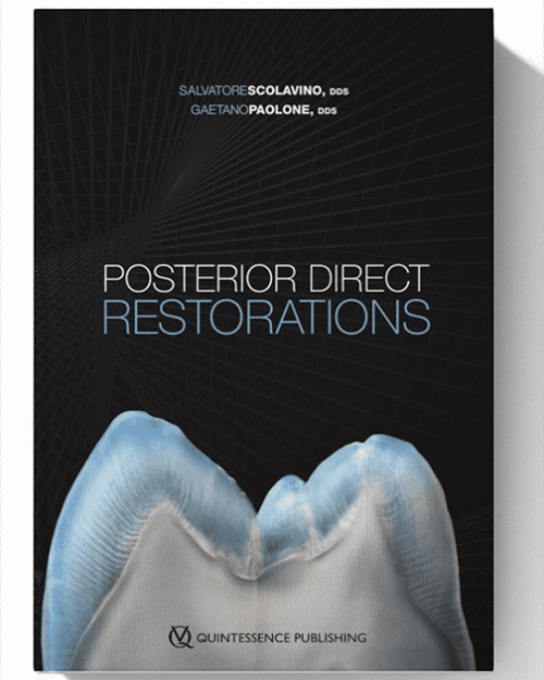 Posterior Direct Restorations 1st Edition